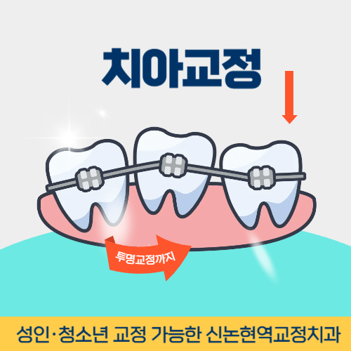 부천시치아교정