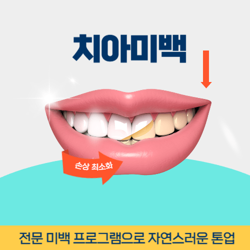 부천시치아미백