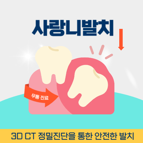 부천시사랑니발치