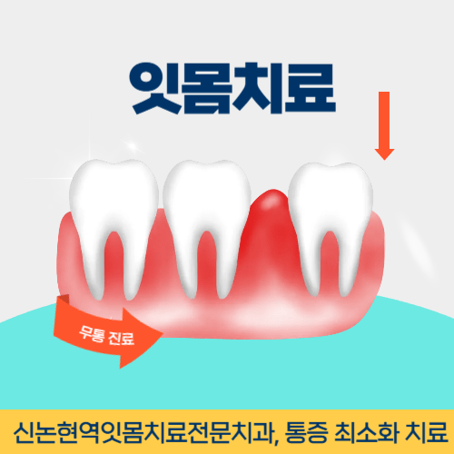 부천시잇몸치료